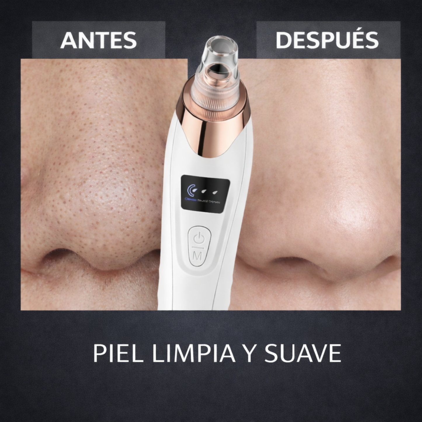 Limpiador Facial Eléctrico Removedor de Puntos Negros